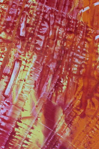 Hibiscus Haze, a detail from the painting Fiery Bang!
